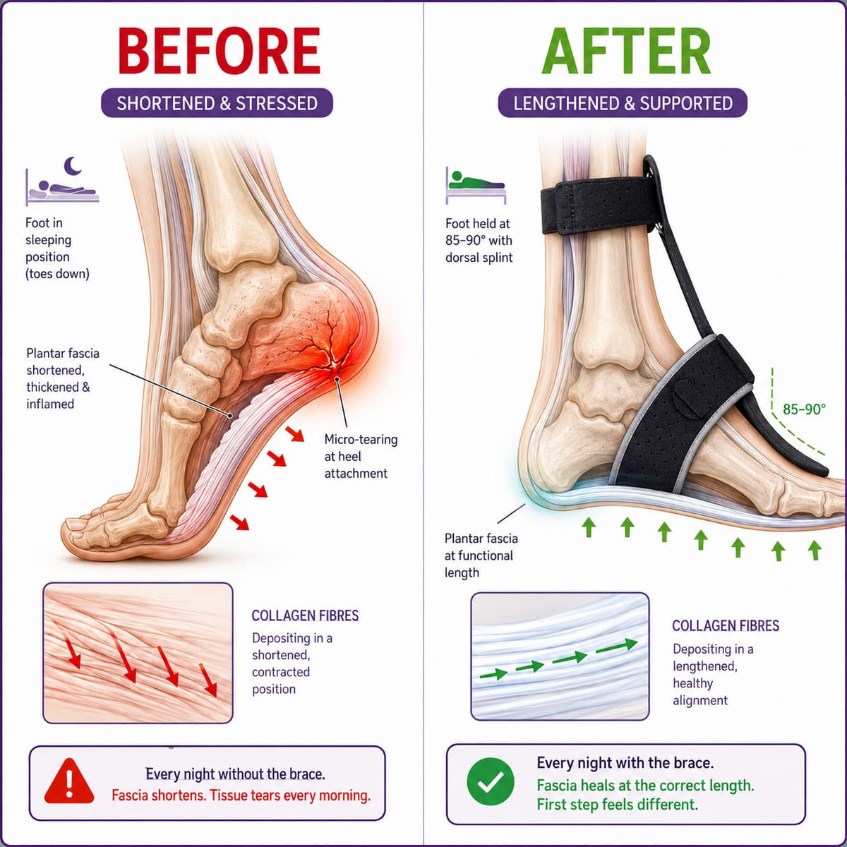 The GlowLift Fascia Brace V2